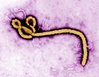 Illustration for article titled The CDC Says Flying Is Mostly Risk-Free From Ebola Exposure